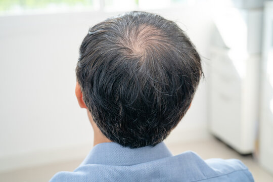 Bald in the middle head and begin no loss hair glabrous of mature Asian business smart active office man.