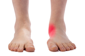Fototapeta premium Close-up of bare adult feet showing flat-footed arch and ankle on a white background, useful for foot health, podiatry, or orthopedic contexts.