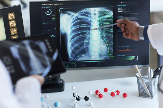 Doctors reviewing chest X ray on medical monitor, pointing at lung scan data for diagnosis and treatment planning. Ideal for healthcare technology, radiology, AI diagnostics marketing
