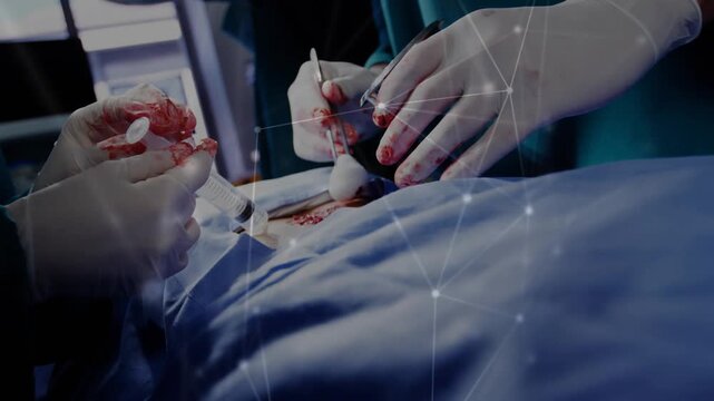 Stopping bleeding, two gloved staff suctioning and packing incision in OR, in teal scrubs, overlay