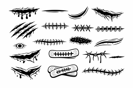 Stylized Monochrome Vector Set of Various Skin Lacerations, Surgical Stitches, Claw Marks, and Healing Wounds. Graphic Elements for Tattoo Design, Horror Art, Medical Illustration, and Scars.