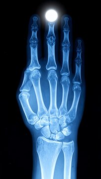 X-ray vision - A hands skeletal structure illuminated by a bright orb.
