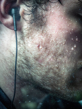 User, empathy, mapping are included as required.Close up of user wearing earphones with facial hair and acne visible, showing empathy for skin issues and mapping texture of skin candid