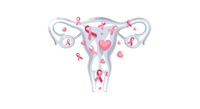 A metallic silver uterus is filled with numerous pink awareness ribbons and floating hearts on a clean white backdrop with bright and hopeful pink accents.
