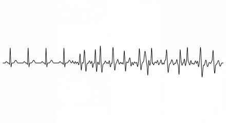 Obraz premium An image showing a rhythm disorder. 