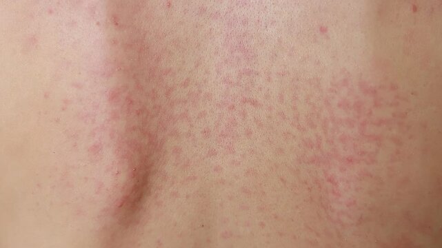 Skin condition shows redness and spots in a close-up view, possibly indicating irritation or rash from an allergic reaction or skin issue.