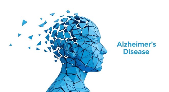 Alzheimer's Disease disintegrating brain cells in motion video