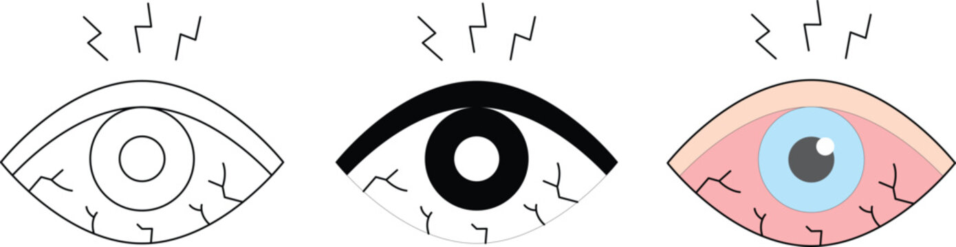 Eye Strain Illustration Set, Tired Dry Eye Symptoms Vector with Pain and Fatigue Concept