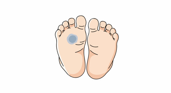 Two feet shown from the sole, with toes and a blue bruise on the left foot
