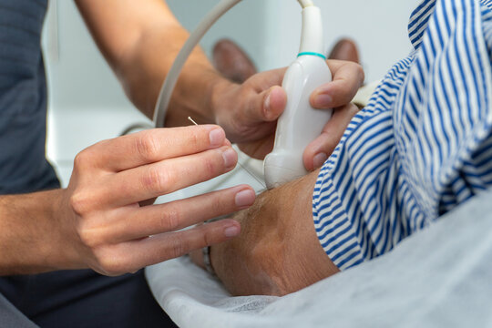 Close-up dry needling guided by ultrasound on adult arm