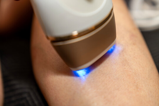 Female hand using IPL laser hair removal device on leg at home. beauty, skincare, smooth skin, permanent hair removal, self care, personal grooming, painless treatment,  beauty center  routine
