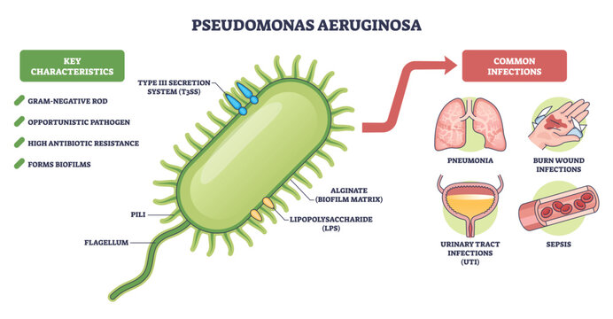 Pseudomonas aeruginosa brief diagram explains this gram negative pathogen and its diseases, focusing on bacterium cell, flagellum, and pili for quick study. Outline diagram