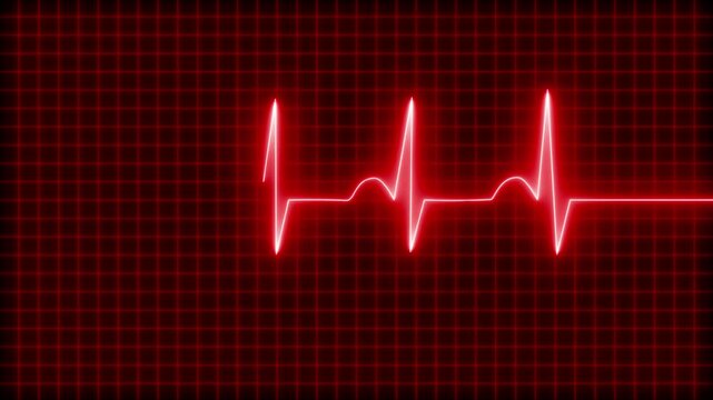 Continuous Neon Heartbeat Wave Motion, Glowing ECG Heartbeat on Grid Background