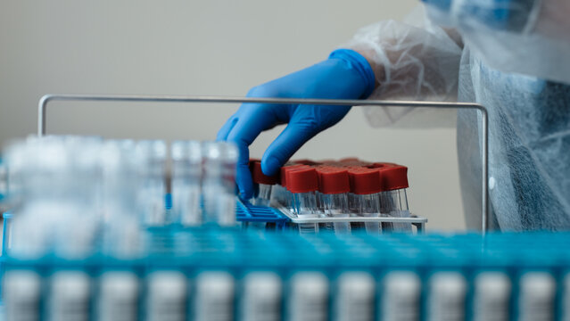 Laboratory technician in protective gear handling blood sample vials with red caps, organized on a tray in a clinical laboratory setting
