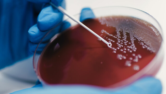 Microbiology testing with petri plate being inoculated using sterile loop by gloved hand in laboratory setting, clear agar medium visible with bacterial growth