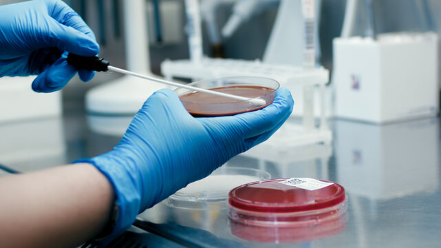 Laboratory technician in blue gloves uses a sterile swab to collect a sample from a petri dish in a modern scientific research facility