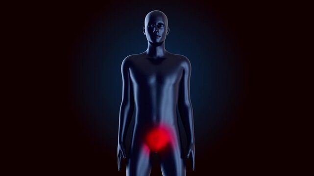 Medical 3D animation showing human silhouette with red inflammation in pelvic and groin region. Concept for bladder pain, urological issues or reproductive health symptoms.