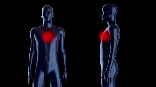 3D medical animation featuring front and side views of male silhouette with glowing red chest area. Visualizes heart disease, angina or respiratory discomfort from multiple perspectives.