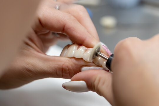 A dental technician meticulously polishes a ceramic prosthesis. Macro shot of hands creating a dental bridge with a specialized tool in a laboratory, highlighting precision and cosmetic dentistry.