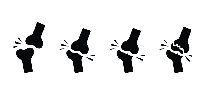 Cartoon knee bones. Bones icon set. Anatomy, human knee bone snatomy concept. Broken knee joint with pain. Bone joints. Science design. Structure of the knee joints. Human leg.