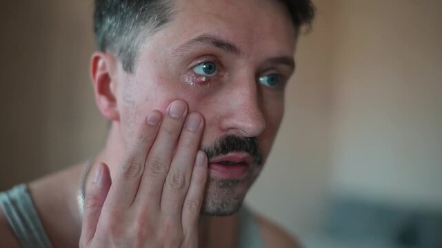 A man observes and studies the effects of chalazion on his eye and facial area. He appears to be in a home setting, analyzing the inflammation and discomfort with careful attention