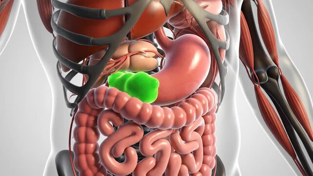 A scientific 3d rendering precisely illustrates a green mass near the pancreas and stomach within the human digestive system, set against a clean, light background.