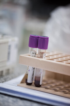 Young Middle Eastern doctors and medical technician handling blood test tubes in clinical laboratory setting