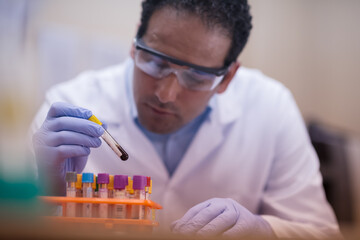 Lab technician carefully handling blood test sample in clinical laboratory wearing gloves and...