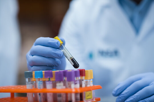 Middle Eastern medical team handling blood samples in a clinical testing lab with gloved technician