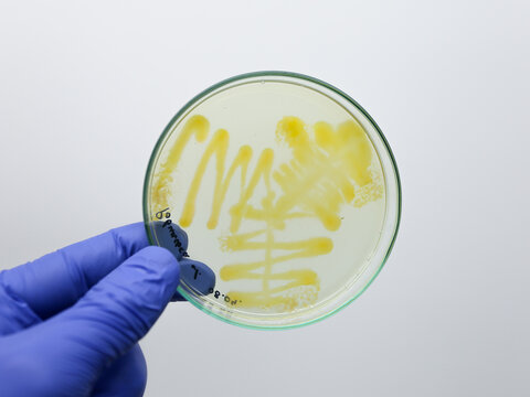 Petri dish with three-petal bacterial growth on petri agar. Analysis of microbial growth on a petri dish.
