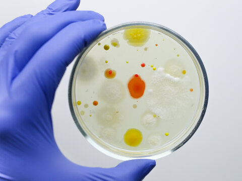 Petri dish with large red colony of bacteria, scientist holding petri dish on grey background.