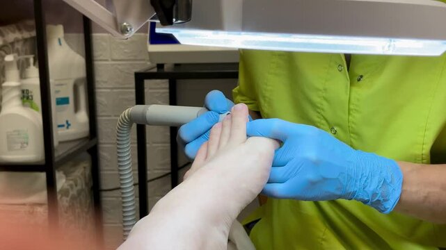 Doctor specializing in foot and nail diseases who treats gloved nails in clinical setting, removes the nail plate with an electric drill, pays special attention to diabetic foot care and sterility.