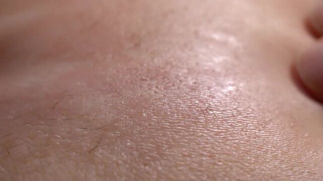Close-up of dry, flaky skin on a human body, showing signs of irritation and dehydration.