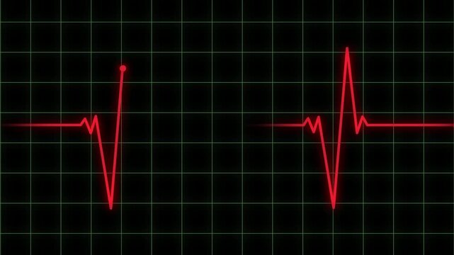 Electrocardiogram heart monitor graph showing abnormal erratic rhythms and flatline effect.
