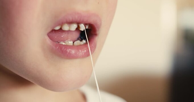 Close-up of a boy mouth with loose front teeth. He has tied a dental floss string to one of them to pull it out and is tugging on it.