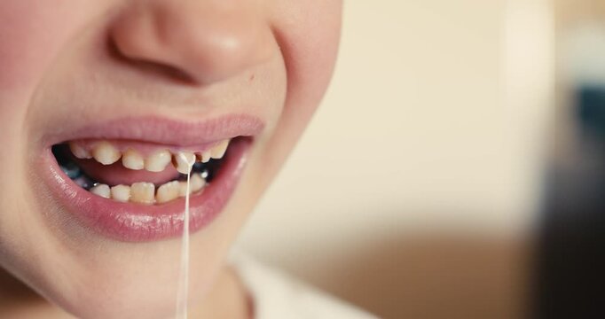 Close-up of a boy mouth as his first baby teeth are about to fall out. He pulls on a dental floss string tied to the tooth to remove it faster. Moments of growing up.