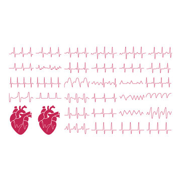 Electrocardiogram readings with anatomical images of the human heart