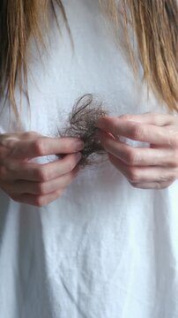 Worried woman holding clump of fallen hair in her hands, visual representation of hair loss, alopecia, telogen effluvium, stress, anxiety, or health problems like hormonal imbalance. Vertical video.