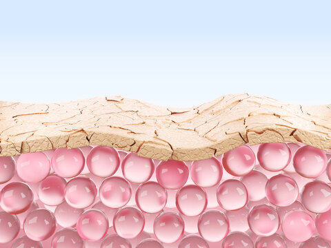Dry, cracked skin indicates damage to the skin barrier and dehydration 3D rendering.