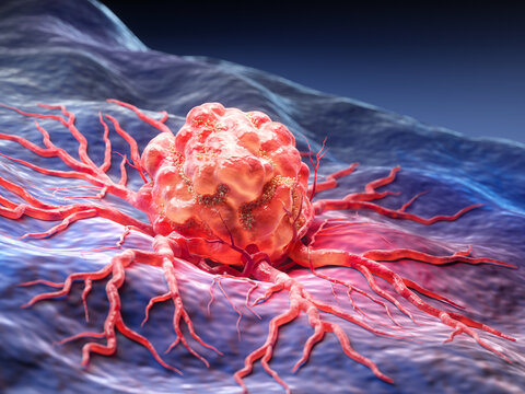 3D Medical illustration of red cancer cells or tumor growing and attaching to the healthy cell wall.