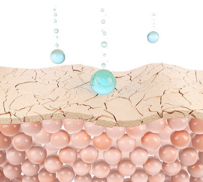 Dry, cracked skin indicates damage to the skin barrier and dehydration 3D rendering.