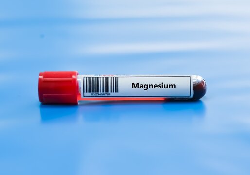 Blood sample tube for magnesium test analysis.