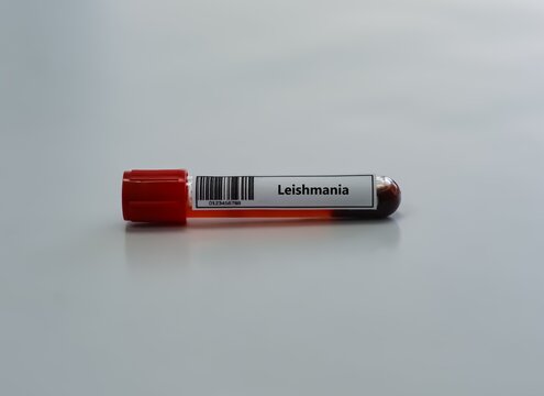 Blood sample tube for leishmania test analysis.