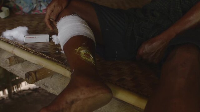 Person wrapping a gauze bandage around an injured leg after applying ointment in a rural setting