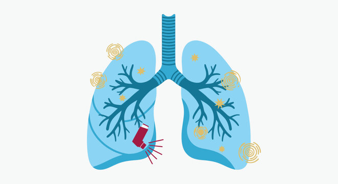 Illustration of lungs with an asthma inhaler and symptoms