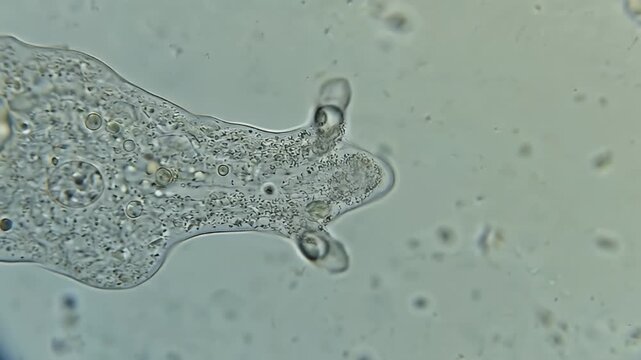 Microscopic view of a single-celled Amoeba proteus organism showcasing its pseudopods contractile vacuoles and granular cytoplasm under a microscope