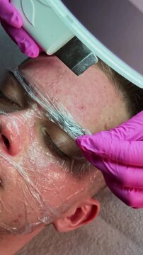 A person is lying down with a protective covering on their face. A professional uses a dermaplaning tool with pink gloves to remove dead skin while the person relaxes.