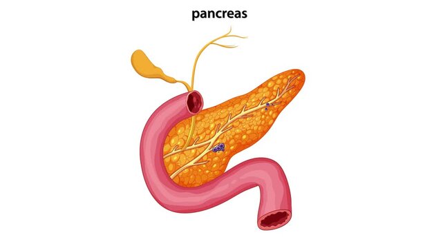 Medical animation showing pancreatic cancer metastasis to lymph nodes and liver within human digestive system.