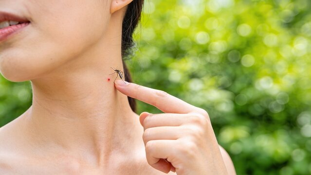 Woman pointing at insect bite on her neck, with a mosquito visible on her skin, surrounded by blurred green foliage in a natural outdoor setting