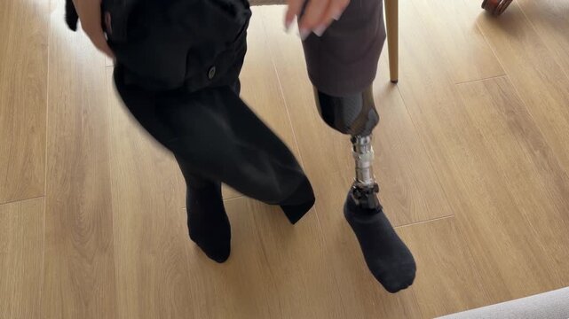 Person with prosthetic leg putting on trousers